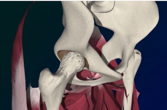 Hip surgery