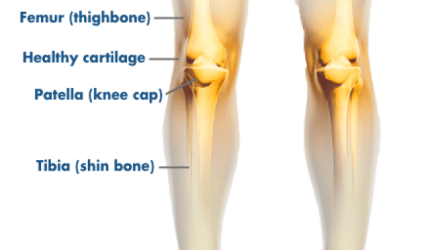 knee - why knee hurts 2